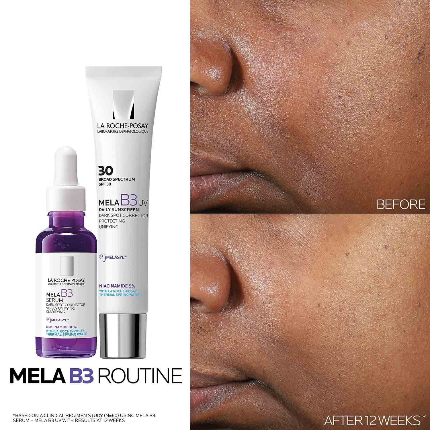 Mela B3 Dark Spot Serum With Melasyl™ + Niacinamide